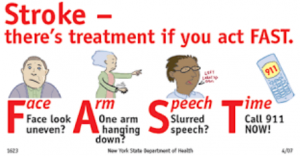 Stroke Symptoms